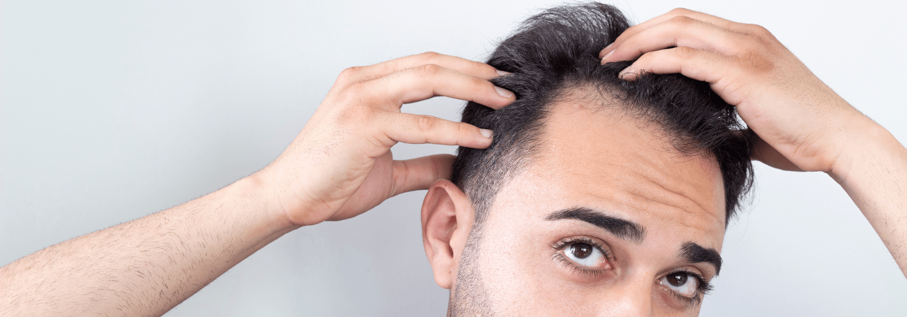 hair loss treatment men